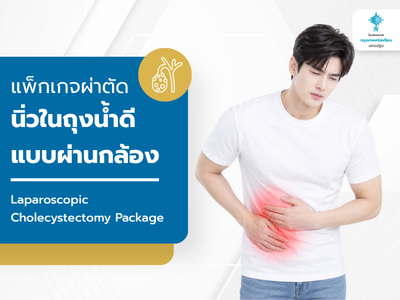 แพ็กเกจผ่าตัดนิ่วในถุงน้ำดีแบบผ่านกล้อง